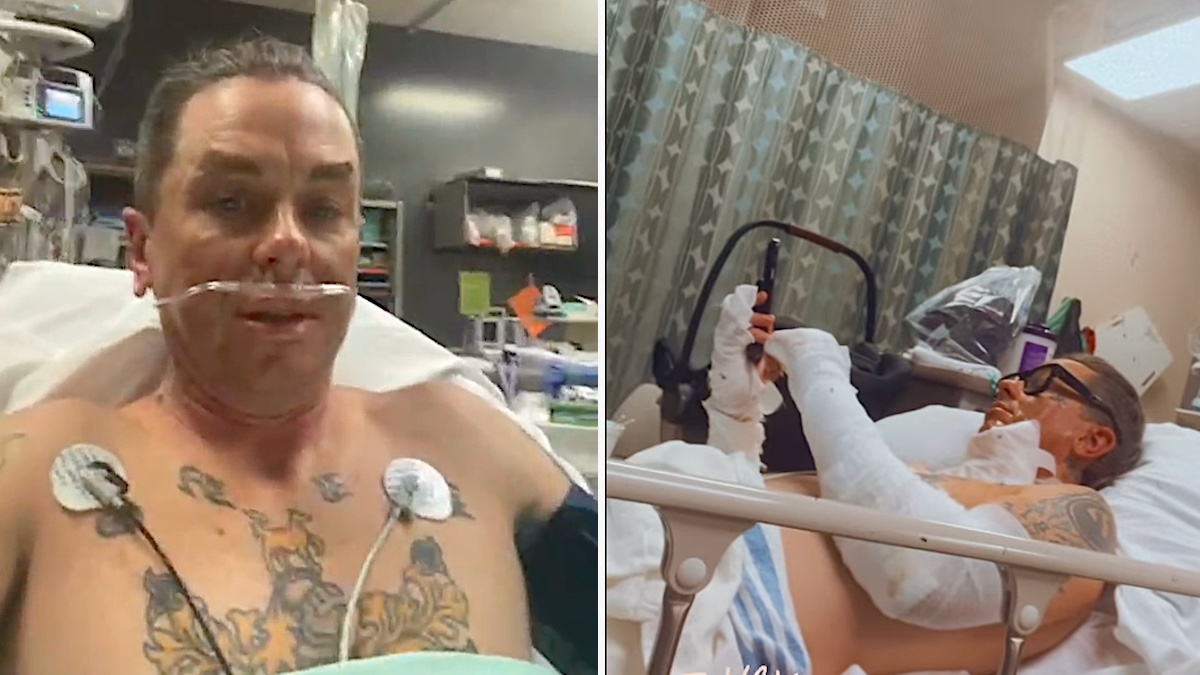 Slipknot’s Sid Wilson Suffers Serious Burns in Accident