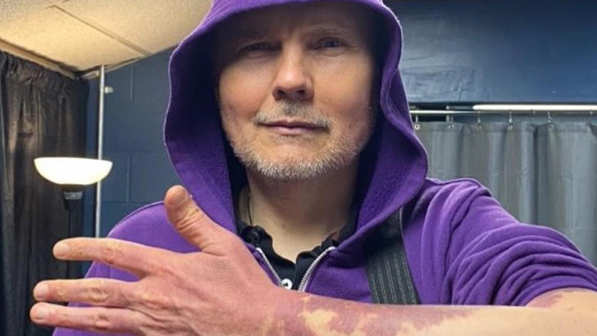 Billy Corgan dévoile ses taches de naissance dans un message de positivité corporelle